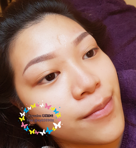 熱臘除毛~臉頰~特價600元