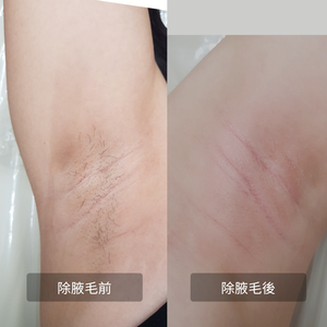 熱臘除毛~臀部~特價1500元