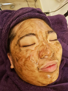 周年慶~臉部保養 藻針淨顏優惠:5堂8500元